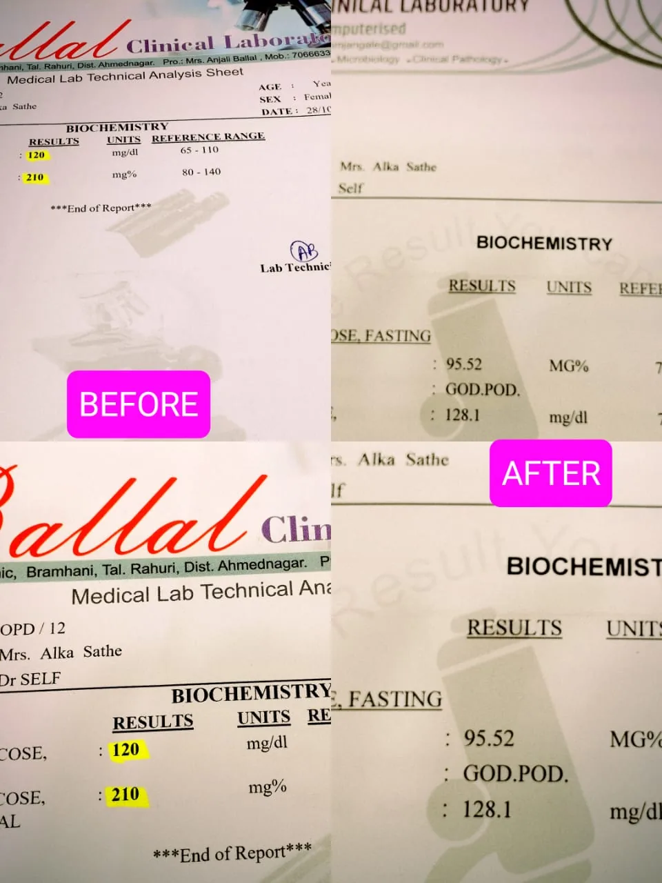 Lab report showing before and after results of homeopathic kidney stone treatment