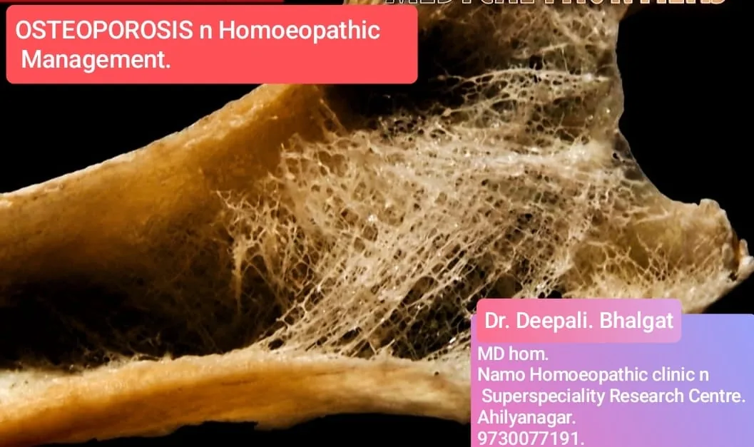 Osteoporosis homeopathic management